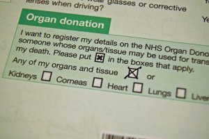 Cheap write my essay benefits of organ donation