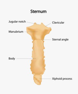 Pain sternum popping Sternum Popping: